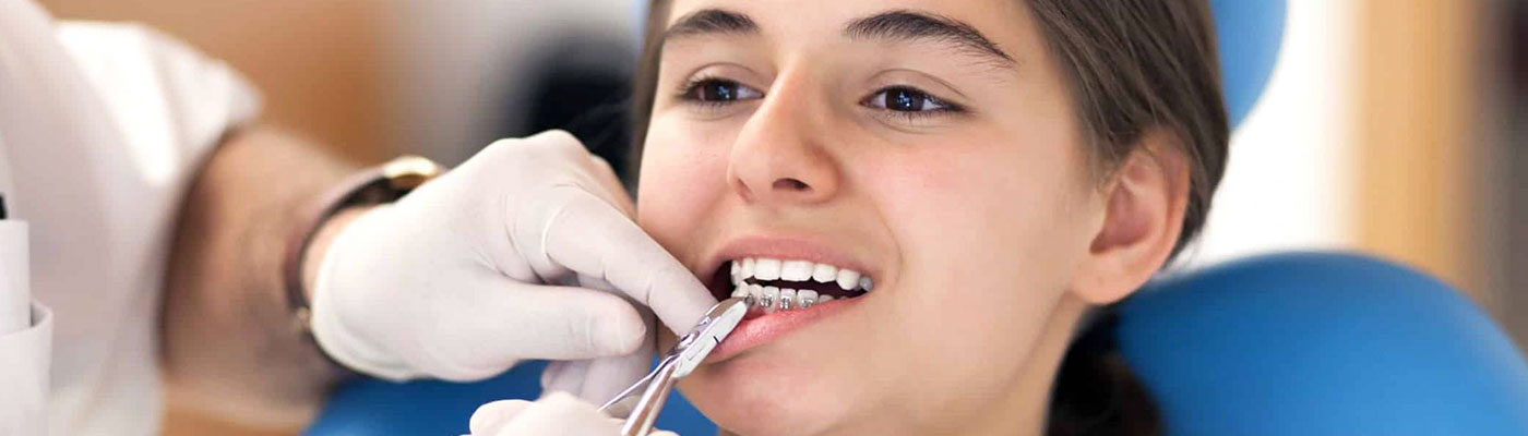 Orthodontics Treatment