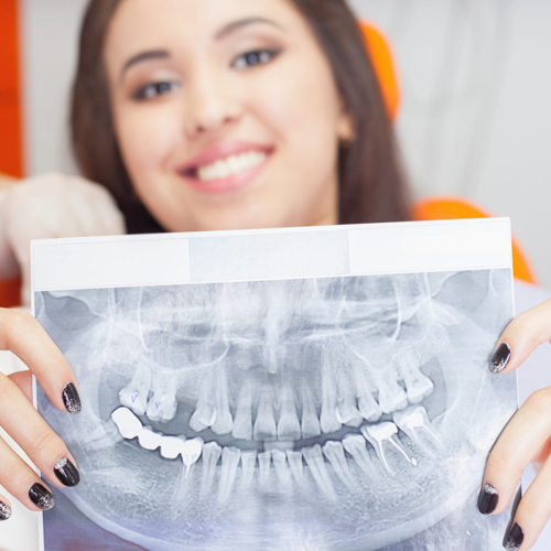 Digital Full Mouth Panoramic X-ray