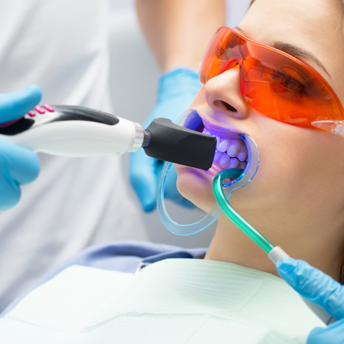 Laser Gummy Smile Correction