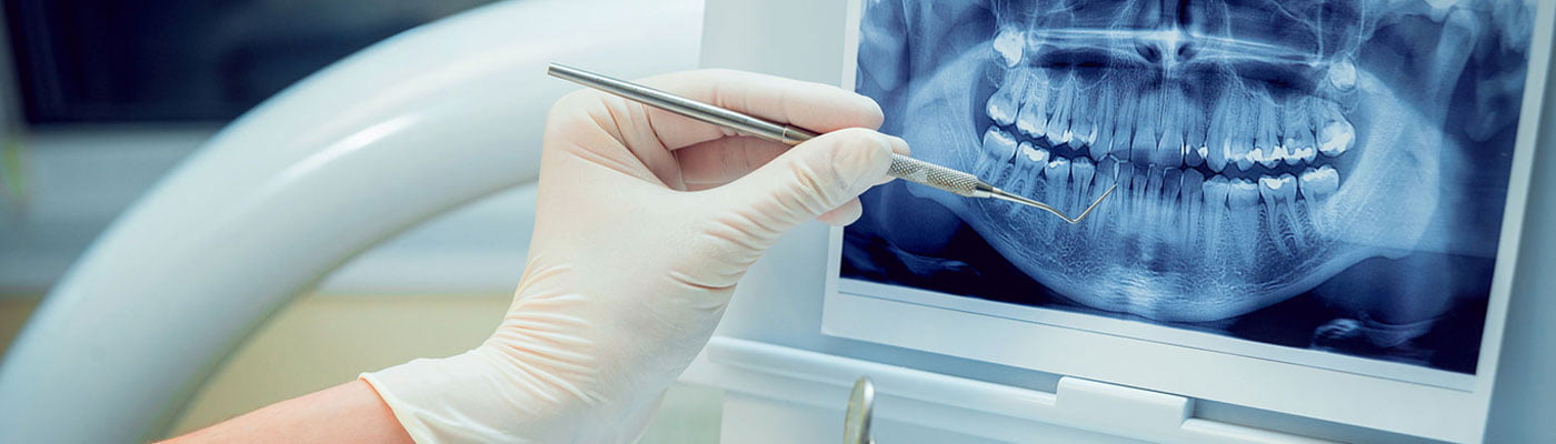 Nobel Guide Computer Guided Surgery