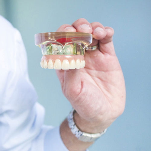 Nobel Biocare - Dental Implants