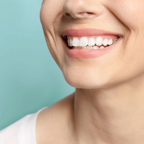 Teeth Whitening