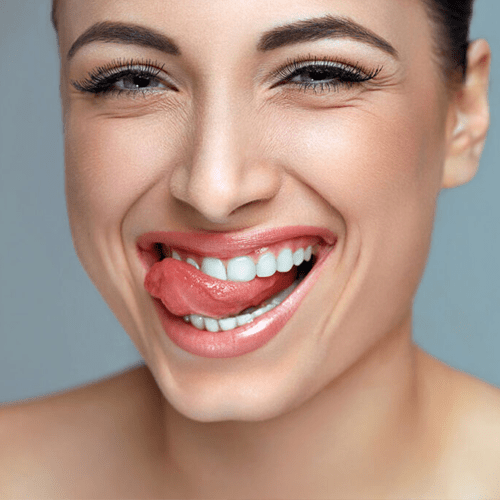 Laser Gums De Pigmentation