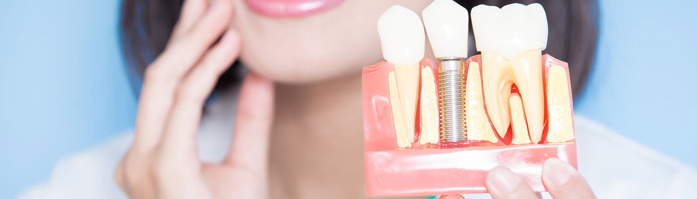 Cosmetic Tooth Colored Fillings